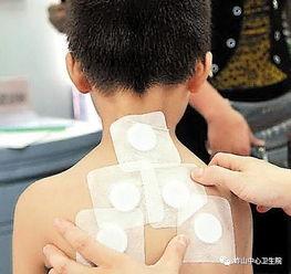 中药透皮视频,古老智慧与现代科技的完美融合